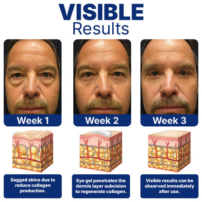 Furzero™  Peptide Ultrasonic Eye Treatment👁️