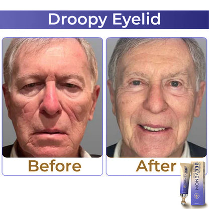 flysmus™ Collagen+ Bee Venom Roller Eye Cream (AU)