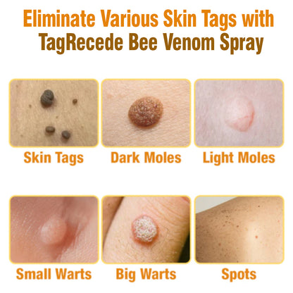 🇦🇺 flysmus™ TagRecede Bee Venom Treatment Spray